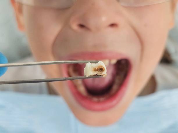 Best Emergency Dentist for Special Needs Patients in New Baltimore, VA