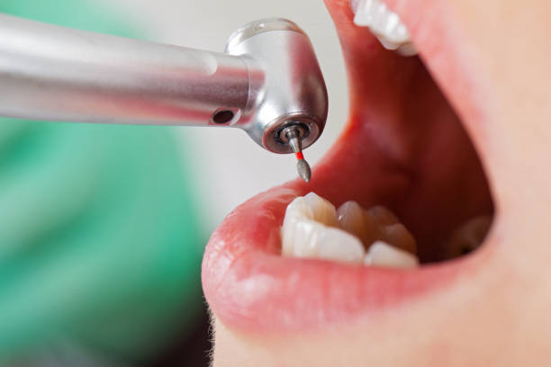 Best Pediatric Emergency Dentist in New Baltimore, VA